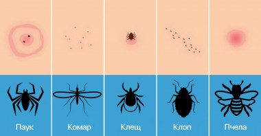 Укусы клещей